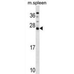 DnaJ (Hsp40) Homolog, Subfamily C, Member 5 Beta (DNAJC5B) Antibody