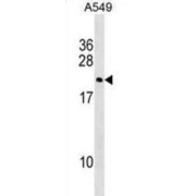 Putative Double Homeobox Protein 3 (DUX3) Antibody