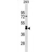 EF-Hand Calcium Binding Domain 4B (EFCAB4B) Antibody
