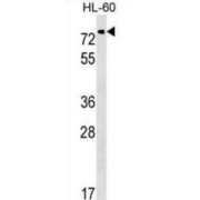 Polypeptide N-Acetylgalactosaminyltransferase 9 (GALNT9) Antibody