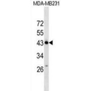 Zinc Finger Protein 550 (ZNF550) Antibody