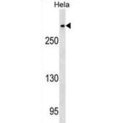 Centromere Protein E (CENPE) Antibody