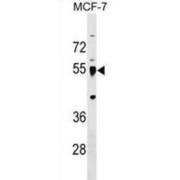 Leucine-Rich Repeat-Containing Protein 42 (LRRC42) Antibody