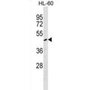 abx029936