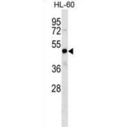 Fez Family Zinc Finger 2 (FEZF2) Antibody