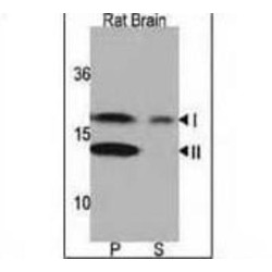 Microtubule-Associated Proteins 1A/1B Light Chain 3A (MAP1LC3A) Antibody