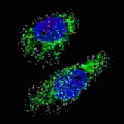 Microtubule-Associated Proteins 1A/1B Light Chain 3A (MAP1LC3A) Antibody