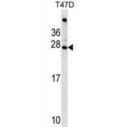 Folliculogenesis Specific Basic Helix-Loop-Helix (FIGLA) Antibody