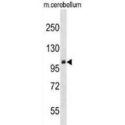 Protein Arginine N-Methyltransferase 9 (PRMT9) Antibody