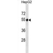 Alanine Aminotransferase 2 / ALT (GPT2) Antibody