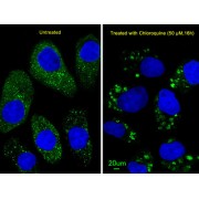 Microtubule-Associated Proteins 1A/1B Light Chain 3A (MAP1LC3A) Antibody