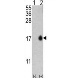 Microtubule-Associated Proteins 1A/1B Light Chain 3A (MAP1LC3A) Antibody