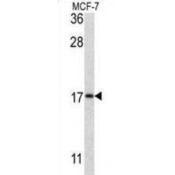 Microtubule-Associated Proteins 1A/1B Light Chain 3B (APG8b) Antibody