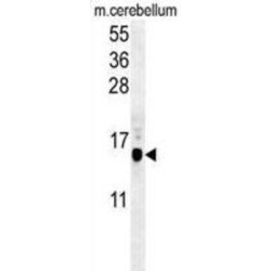 Microtubule-Associated Proteins 1A/1B Light Chain 3B (APG8b) Antibody