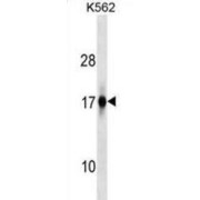 Zinc Finger AN1-Type Containing 2A (ZFAND2A) Antibody