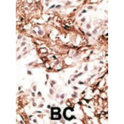 Microtubule-Associated Proteins 1A/1B Light Chain 3A (MAP1LC3A) Antibody
