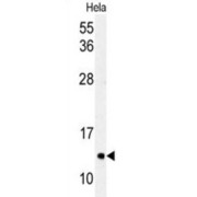 Microtubule-Associated Proteins 1A/1B Light Chain 3A (MAP1LC3A) Antibody
