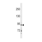 Hedgehog Interacting Protein (HHIP) Antibody