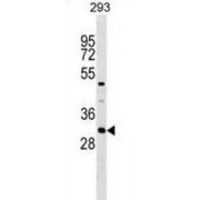 Ankyrin Repeat And SOCS Box Containing 7 (ASB7) Antibody