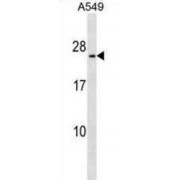 Methyltransferase Like Protein 7B (METTL7B) Antibody
