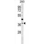 RNA (guanine-9-)-Methyltransferase Domain-Containing Protein 3 (RG9MTD3) Antibody