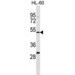 Zinc Finger Protein 187 (ZNF187) Antibody