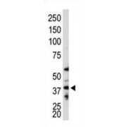 Ubiquitin-Like-Conjugating Enzyme ATG3 (ATG3) Antibody