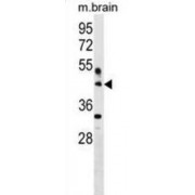 Hyaluronan And Proteoglycan Link Protein 4 (HAPLN4) Antibody