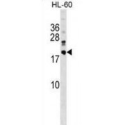 DnaJ Homolog Subfamily C Member 30 (DNAJC30) Antibody