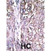 Cysteine Protease ATG4A (ATG4A) Antibody