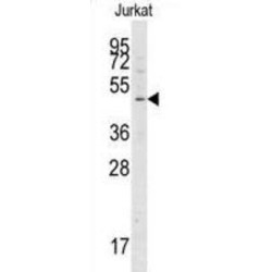 Cysteine Protease ATG4A (ATG4A) Antibody