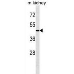 Cysteine Protease ATG4A (ATG4A) Antibody