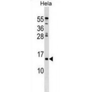 HERV-H LTR-Associating Protein 3 (HHLA3) Antibody