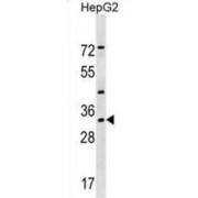 Leucine Zipper Transcription Factor-Like Protein 1 (LZTFL1) Antibody