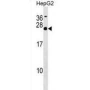 Chromosome 20 Open Reading Frame 20 (MRGBP) Antibody