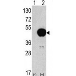 Autophagy Related 4B Cysteine Peptidase (ATG4B) Antibody