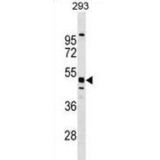 WB analysis of 293 cell line lysates.