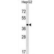 Leucine Rich Repeat Protein 1 / PPIL5 (LRR1) Antibody