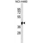 WB analysis of NCI-H460 cells.