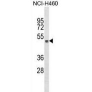 Pyroglutamylated RFamide Peptide Receptor (QRFPR) Antibody