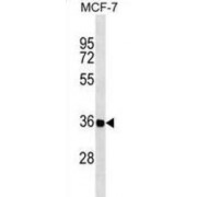 Ras-Like Protein Family Member 12 (RASL12) Antibody