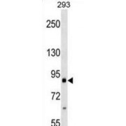 Integrin Beta 2 (ITGB2) Antibody
