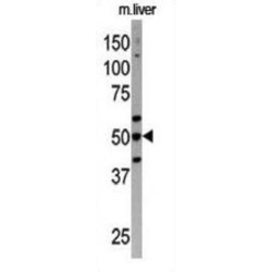 Autophagy Related 4C Cysteine Peptidase (ATG4C) Antibody