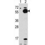 Autophagy Related 4C Cysteine Peptidase (ATG4C) Antibody