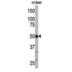 Autophagy Related 4C Cysteine Peptidase (ATG4C) Antibody