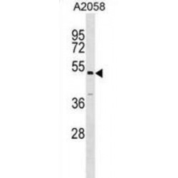 Autophagy Related 4C Cysteine Peptidase (ATG4C) Antibody