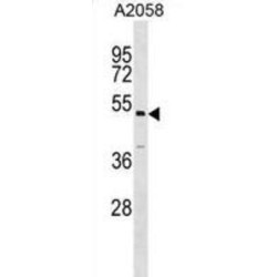 Autophagy Related 4C Cysteine Peptidase (ATG4C) Antibody