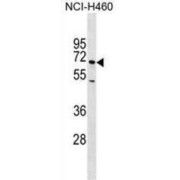 abx030029