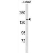 Myosin-9 (MYH9) Antibody