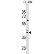 abx030049